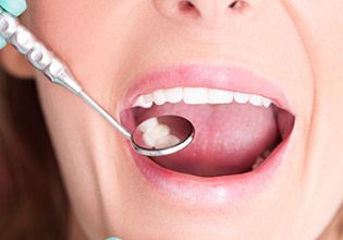 Closeup of smile during dental exam