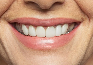 Closeup of healthy teeth and gums