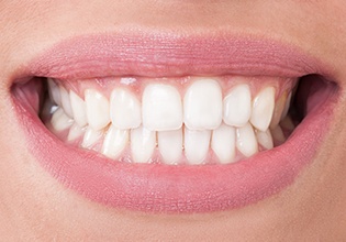 Closeup of healthy teeht and gums