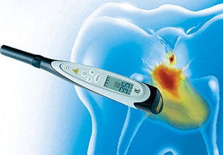 DIAGNOdent cavity detection system